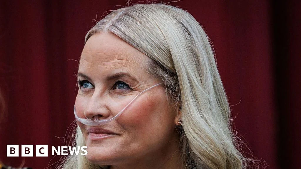 Norway’s Crown Princess Survives Life‑Saving Lung Transplant