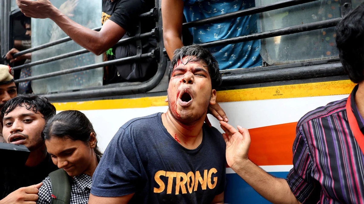 Amnesty reports India used lethal weapons on protesters