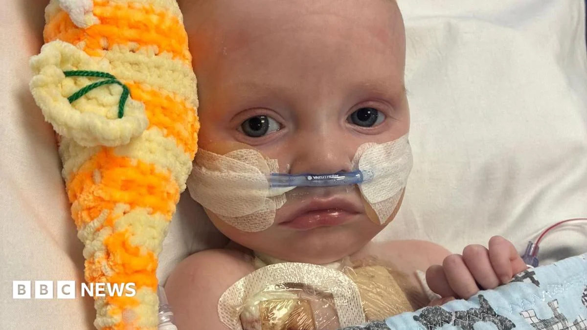 Baby thriving after life-saving heart operation
