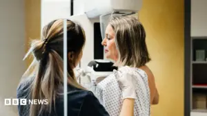 Breast cancer checks miss most under-50 at-risk women