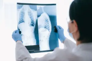 Mobile Lung Screening Unit Targets Remote Aboriginal Communities in Australia