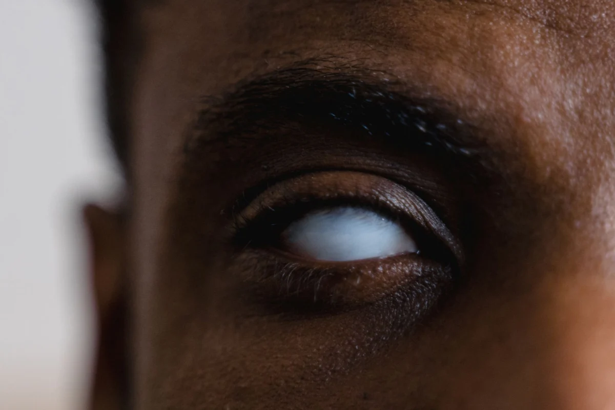 Tarsus to acquire Alkeus for up to $800 million to boost eye disease pipeline