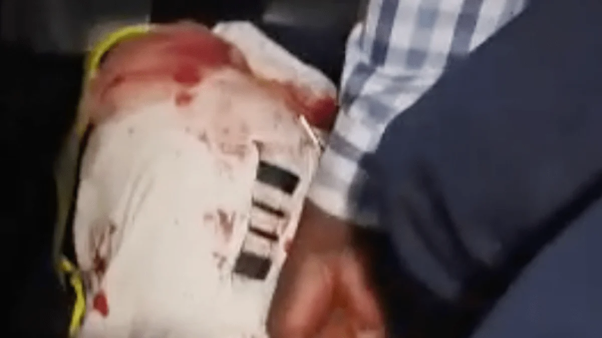 Flydubai Flight Diverted After Pilot Attack, Video Shows