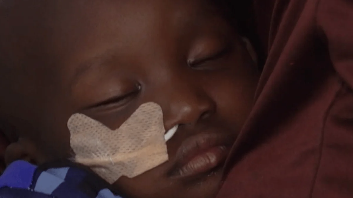 Nigeria Faces Rising Malnutrition Amid Rising Food Costs