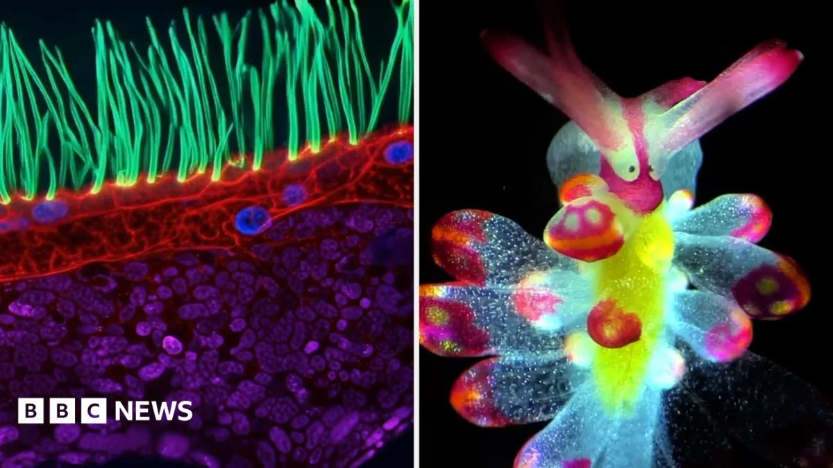 Microscopic Video Contest Shows Organisms in Child’s Airways