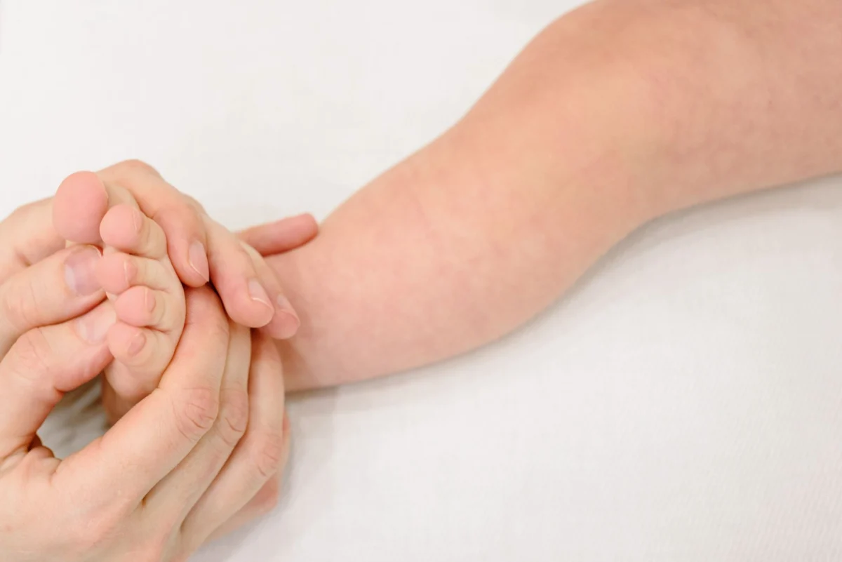 Fourth Measles Death Reported in Pennsylvania, AP News Confirms