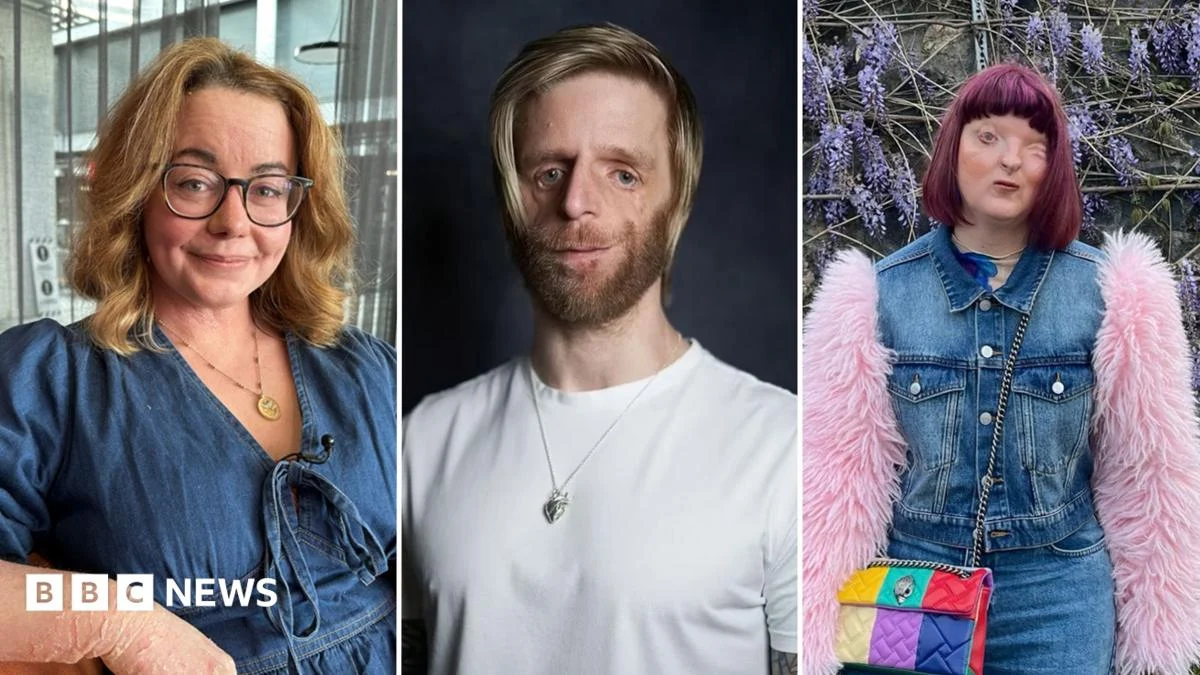 AI ‘Fixed’ Photo of Visible Differences, Sparking Backlash