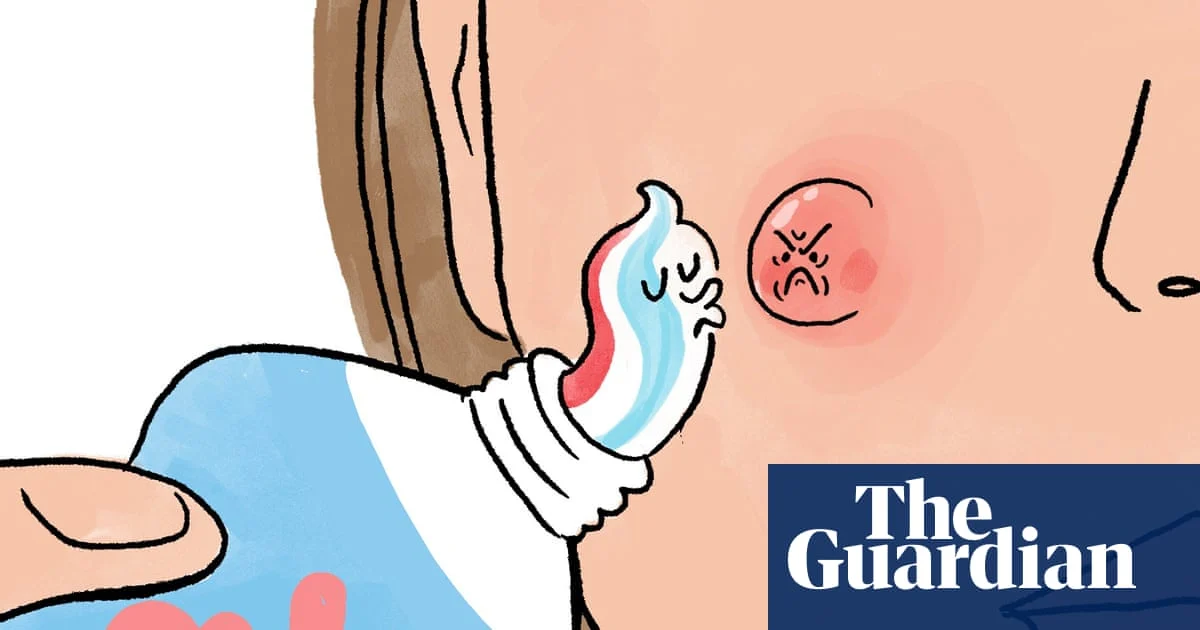 Toothpaste as Spot Treatment: Dermatologist Warns It May Worsen Acne