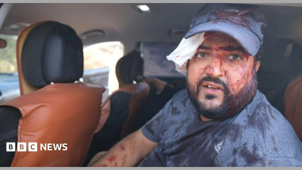 Israeli settlers injure Palestinians, US journalist in West Bank olive harvest attack